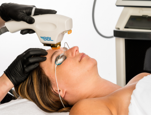 It’s Laser Season: Bucks County’s Best Med Spa Founder’s Guide to Choosing the Right Laser Treatment